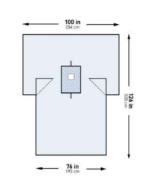 McKesson - Surgical Drape Breast Drape 100 W X 76 W X 126 L Inch Sterile - 183-I80-05214G-S