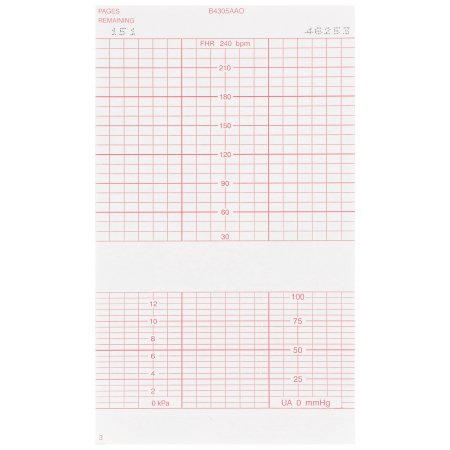 McKesson - Fetal Diagnostic Monitor Recording Paper Thermal Paper 6 Inch X 47 Foot Z-Fold Red Grid - 26-B4305A
