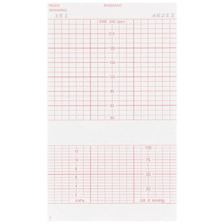 McKesson - Fetal Diagnostic Monitor Recording Paper Thermal Paper 6 Inch X 47 Foot Z-Fold Red Grid - 26-B4305A