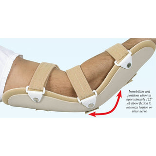 AliMed Cubital Tunnel Splint Cubital Tunnel Splint, Small/Med., 14-3/4"L - 510503