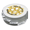 GPI Anatomicals 4 Stage Osteoporosis Model 4 Stage Osteoporosis Model - 52475
