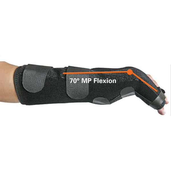 EZY Wrap Boxer Fracture Brace Boxer Fracture Brace, Med./Large, Right - 52503/NA/NA/RMDLG