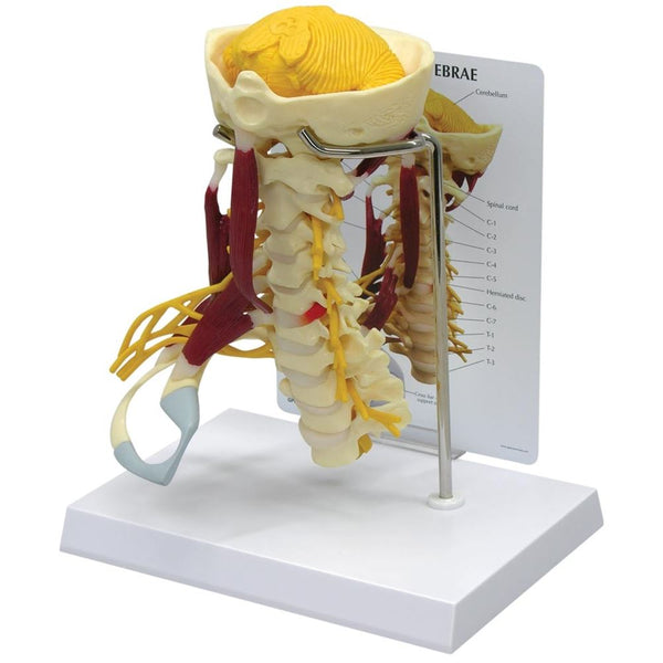 GPI Anatomicals Muscled Cervical Model Muscle Cervical Model - 70122