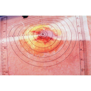 Alimed Disposable Wound Measuring Guides Disposable Wound Measuring Guides - 70831