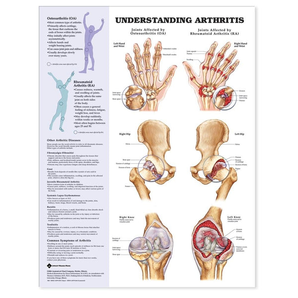 Alimed Anatomical Wall Charts Hand and Wrist Chart - 73447