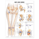 Alimed Anatomical Wall Charts Hip and Knee Inflammations Chart - 73455