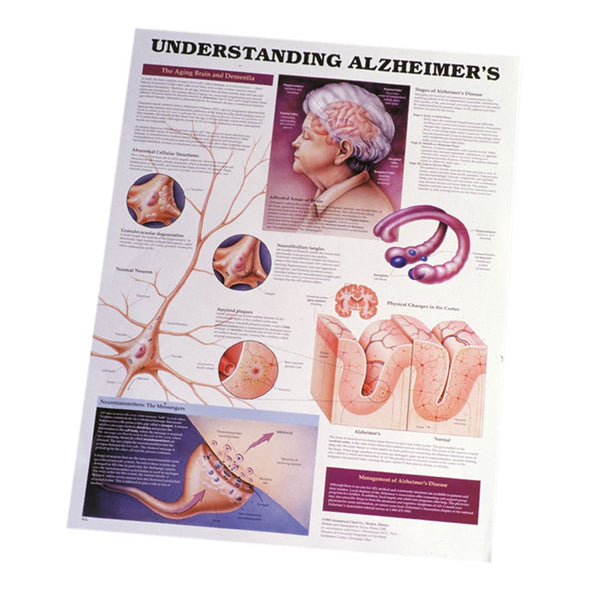Alimed Anatomical Wall Charts Hip and Knee Inflammations Chart - 73455