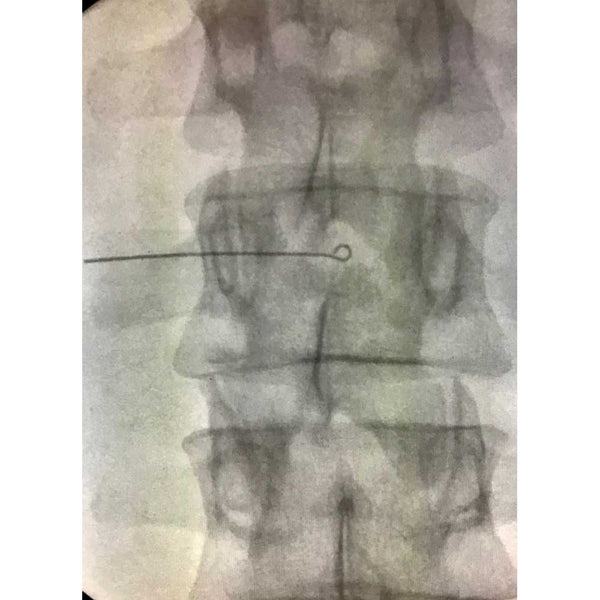 Viscot Accumark Radiopaque Injection Site Markers Radiopaque Injection Site Markers, 10/bx - 939303