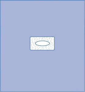Medline Adherent Window Drape - Adherent Window Sheet, Sterile, 41" x 45" - DYNJP2493