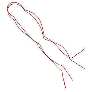 Medline Medi-Loops Mini Vessel Loops - Sterile Mini Vessel Loop, Red - DYNJVL12