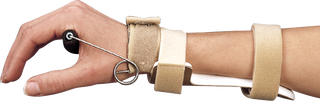 Wrist Extension Splint