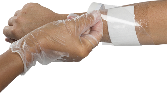 DeRoyal Transeal Plus Transparent Dressing with Absorbent Pad | Devine ...